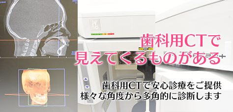 歯科用CTで安心診療をご提供。様々な角度から多角的に診断します。
