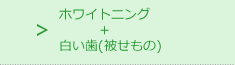 ホワイトニング＋白い歯(被せもの)
